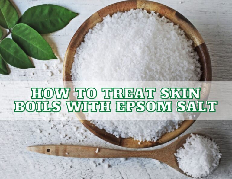 How to Treat Skin Boils with Epsom Salt