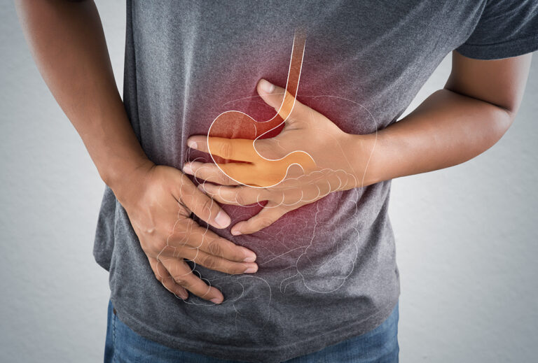 How to Use Almond Milk for Acid Reflux? 2023 Guide